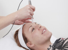Acne Scar Reduction