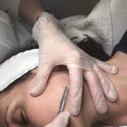 Poole Dermaplaning service
