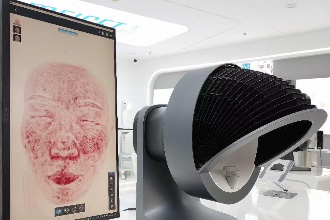 Skin. analysis machine at Harbour Clinic in Poole